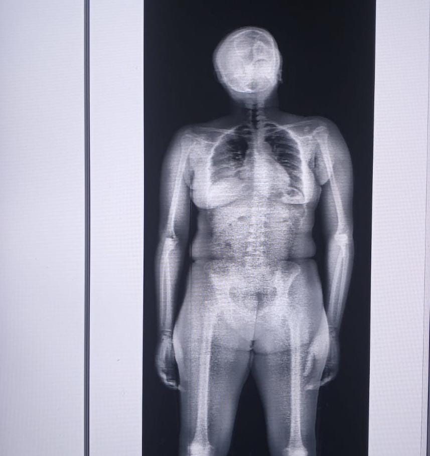 Polícia Penal prende mulher tentando entrar com drogas no Copemcan